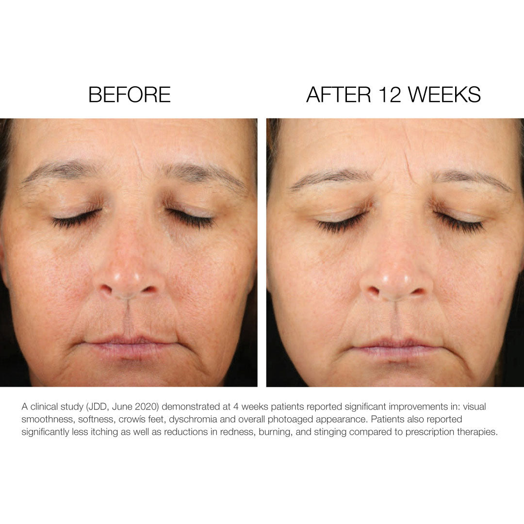 Refine + Renew Retinol 2.5 Lipid Drops