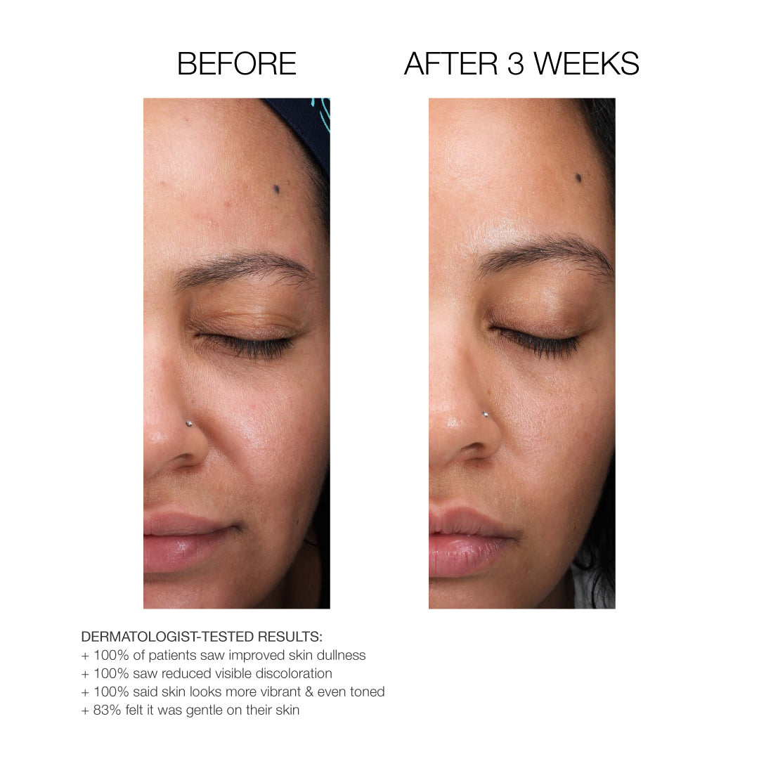 Renew + Glow Serum