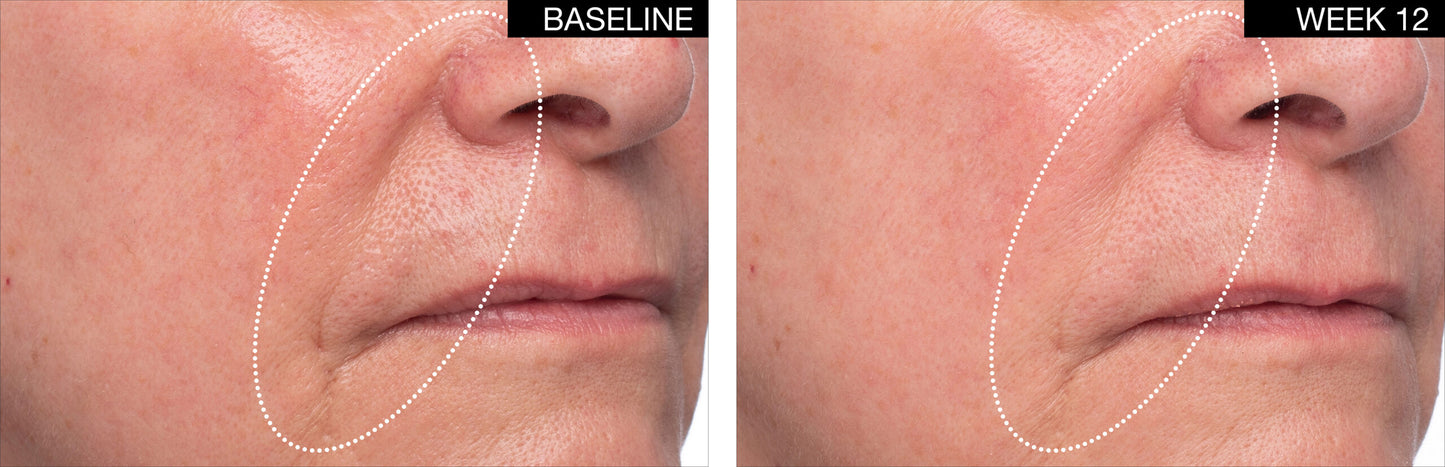 Lift & Volume Restoration Duo