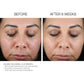 Refine + Renew Retinol 10 Gelée Serum