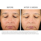 Refine + Renew Retinol 2.5 Lipid Drops