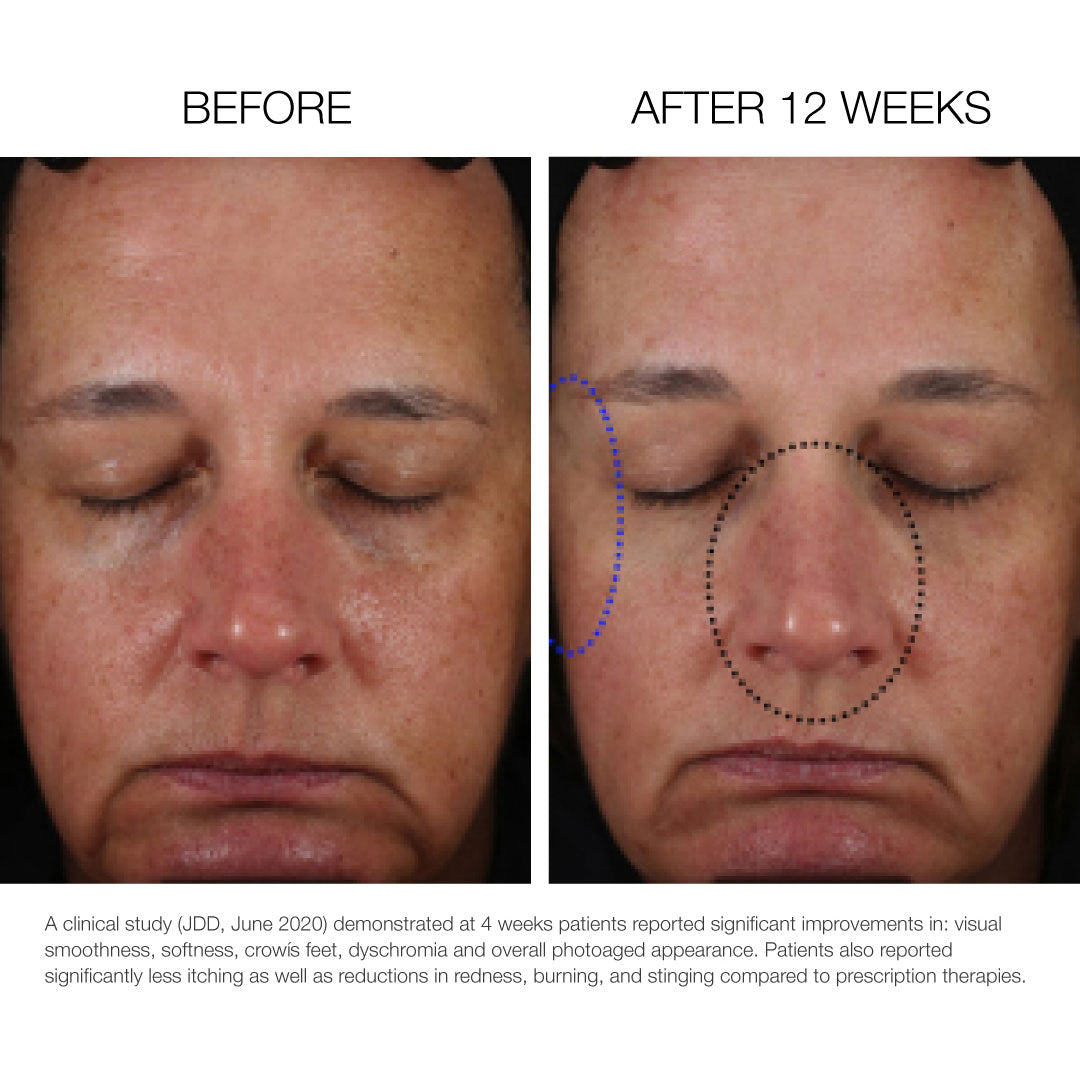 High Potency Vitamin C Complex Lipid Drops