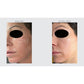 Concentrated Antioxidant Barrier Repair Serum