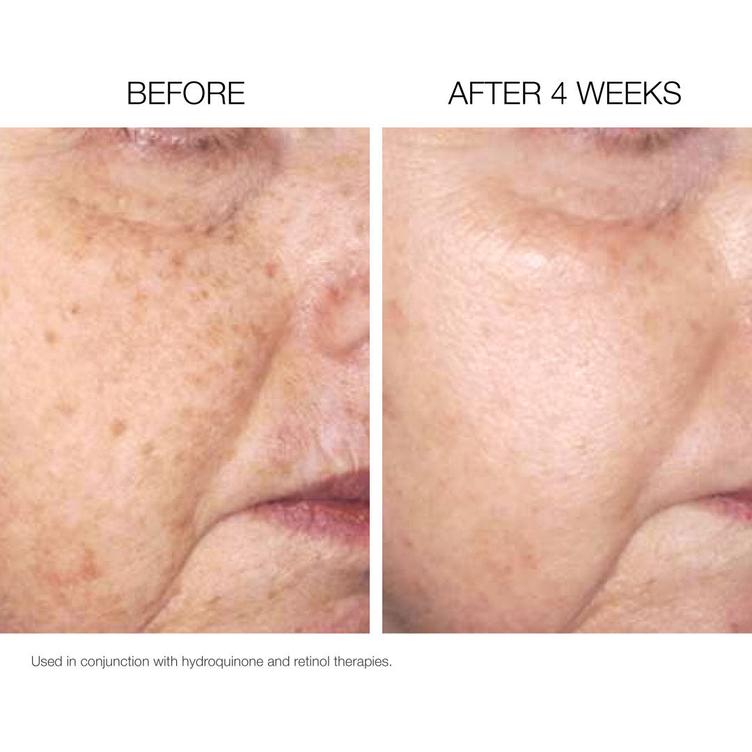 Pigment Balancing Brightening Pads + 2% Hydroquinone