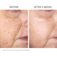 Pigment Balancing Brightening Pads + 2% Hydroquinone