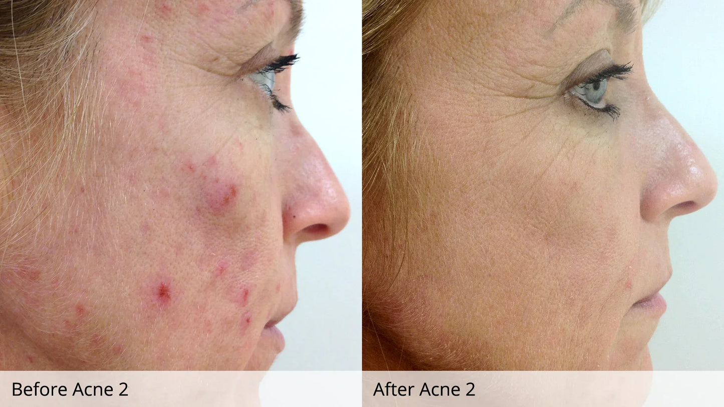 Clear Skin Set