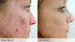 Clear Skin Set