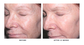 Refine + Renew Retinol 5 Gelée Serum