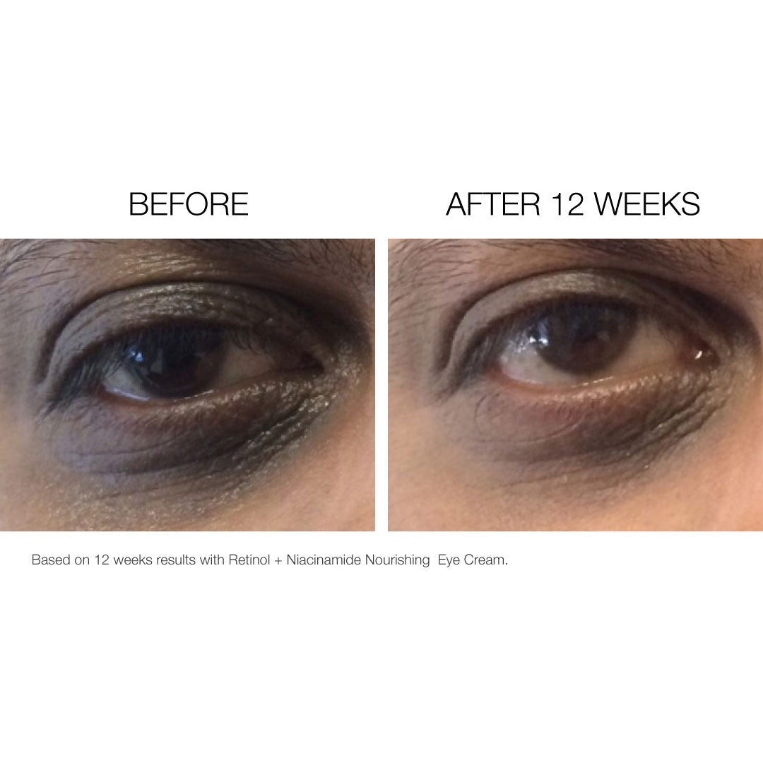 Eye PM Renewal Crème
