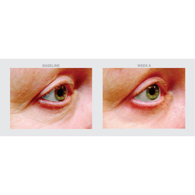 Eye AM Hydrating Serum